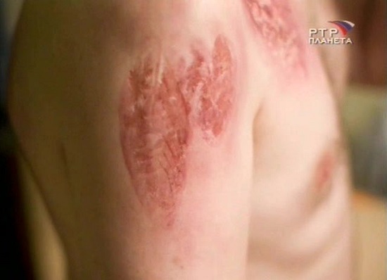 отпечаток молнии