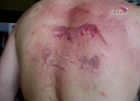 отпечаток молнии