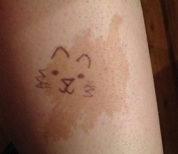 родимое пятно в виде котёнка