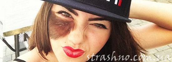 странное родимое пятно