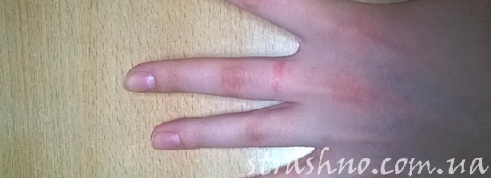 След от кольца на пальце